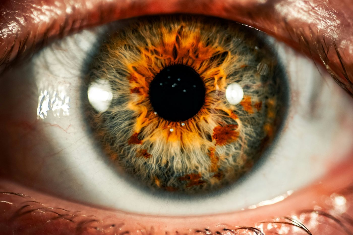Close-up of an eye with red and orange specks